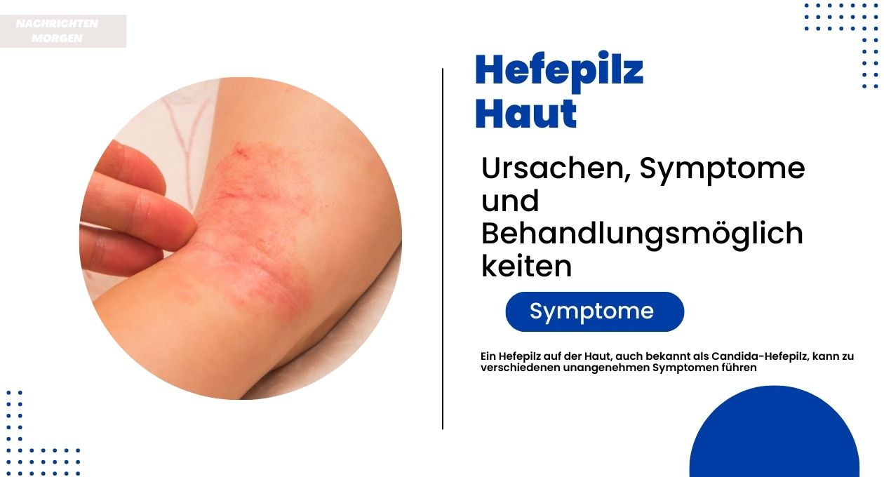 hefepilz haut