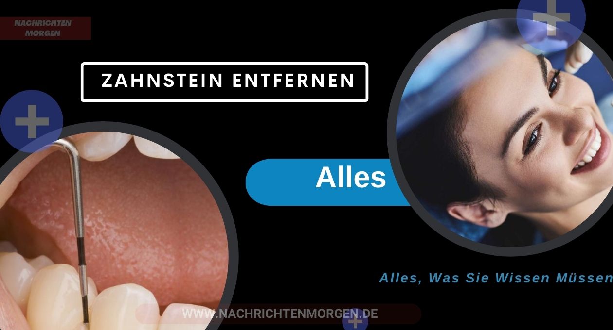 zahnstein entfernen