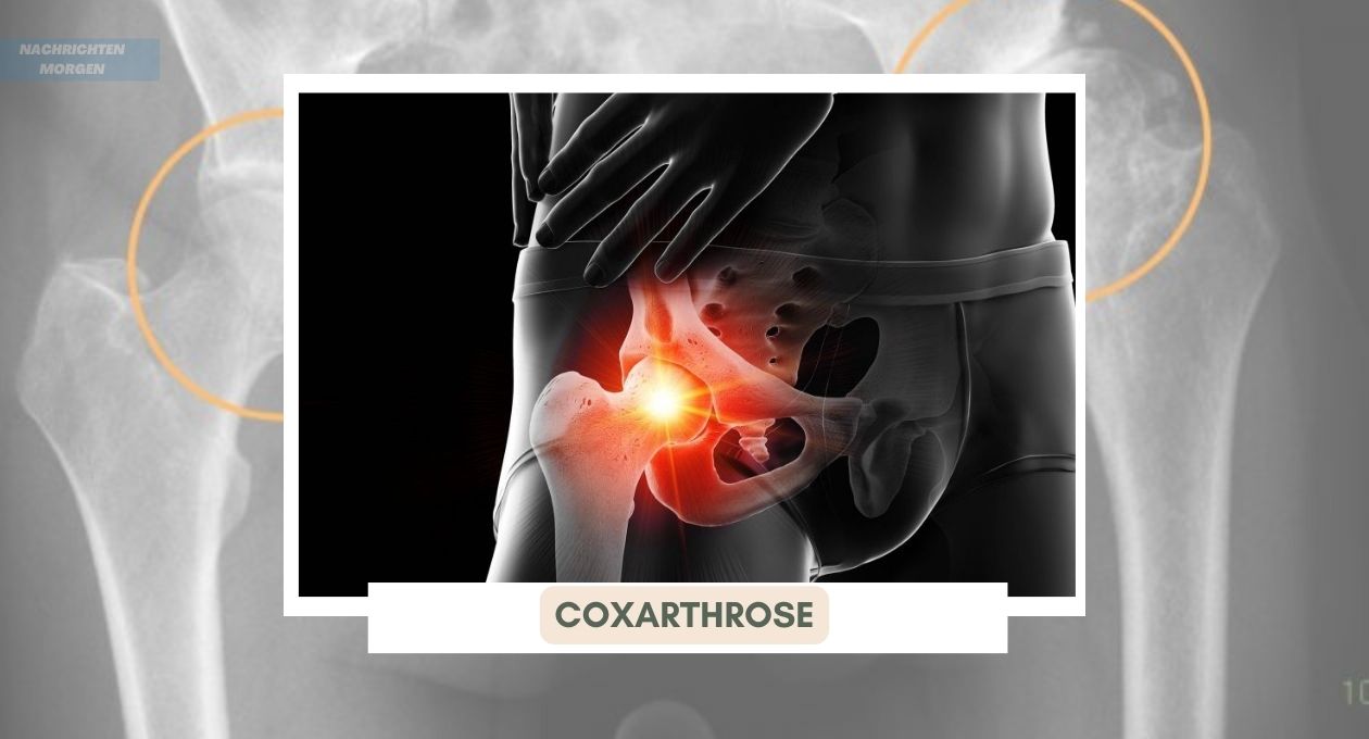 Coxarthrose