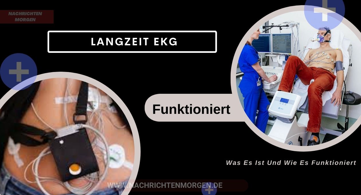 langzeit ekg