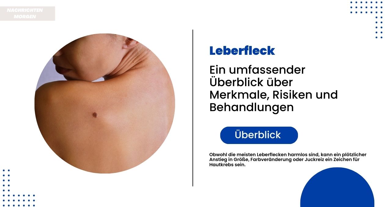 leberfleck