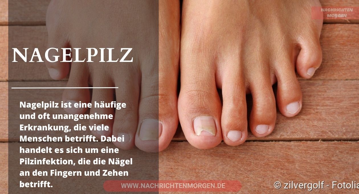 nagelpilz