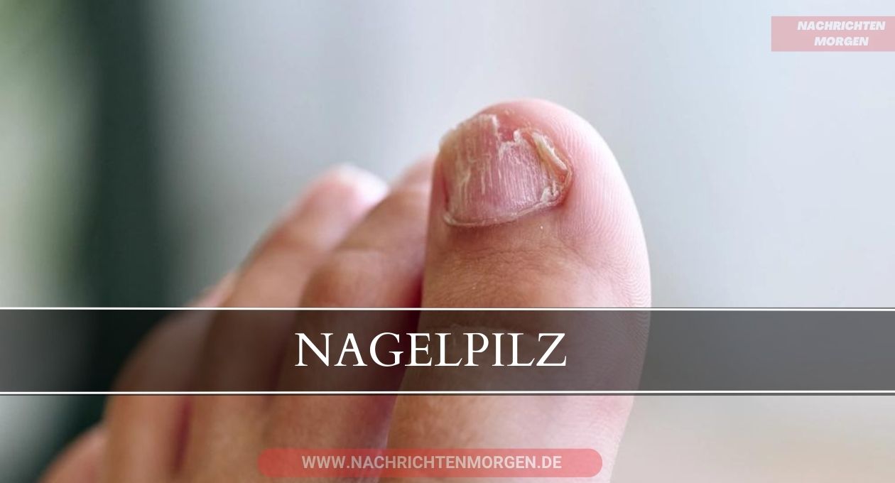 nagelpilz