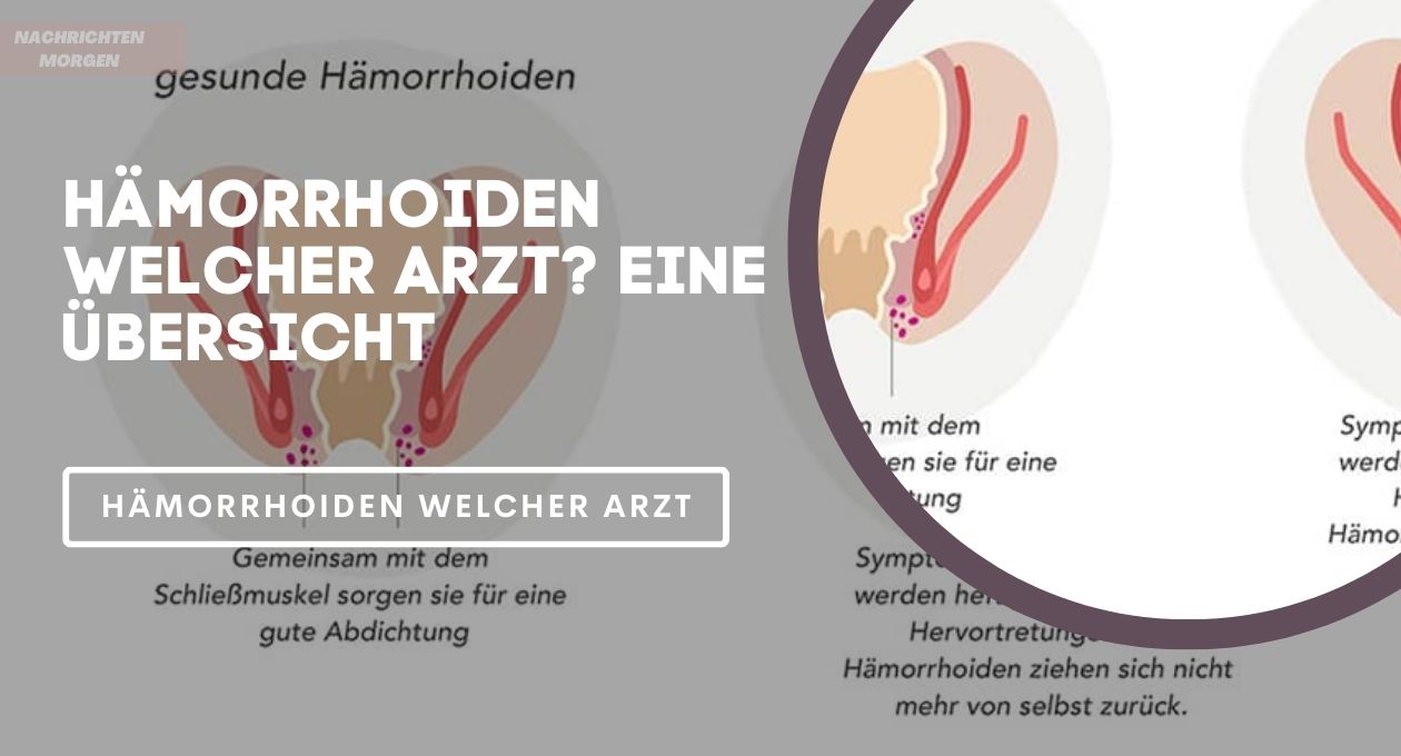 hämorrhoiden welcher arzt