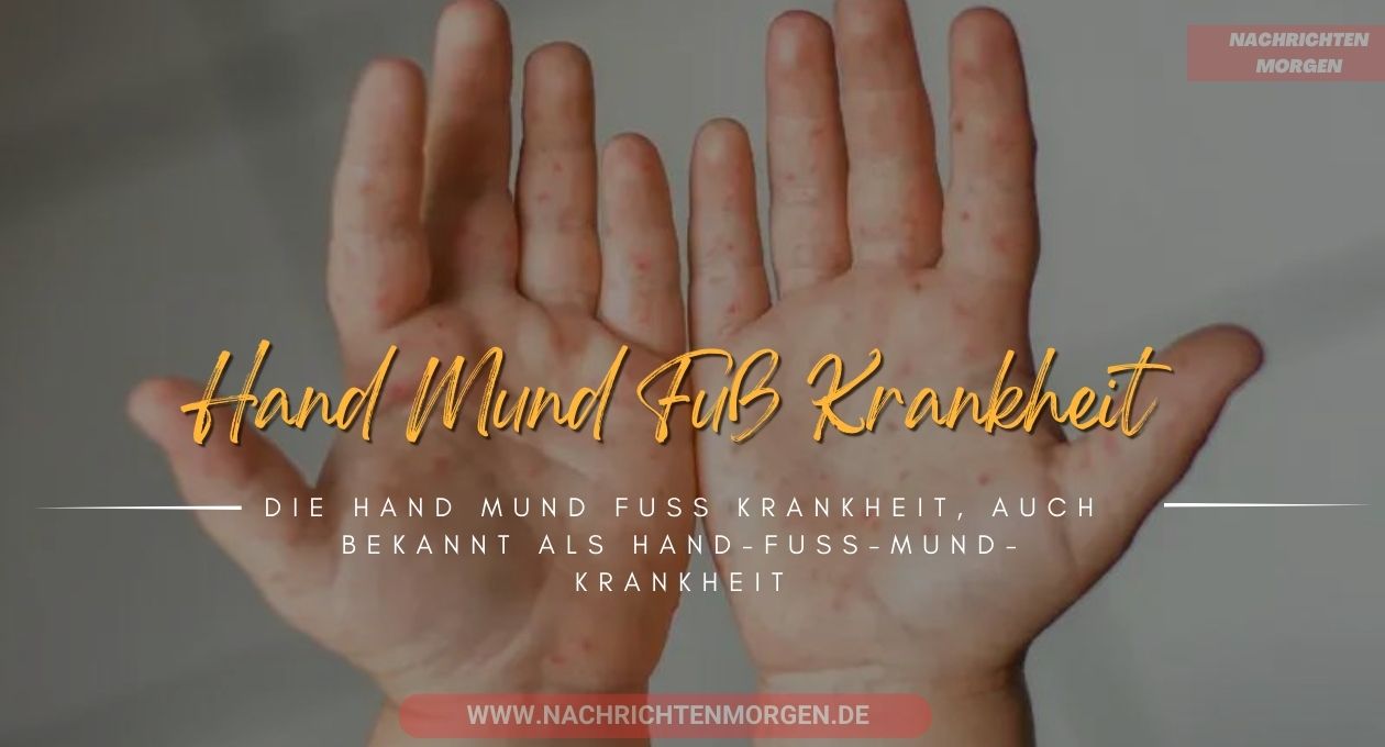 hand mund fuß krankheit a