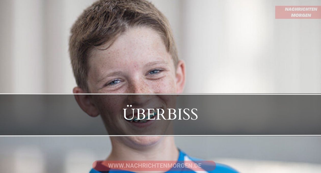 überbiss