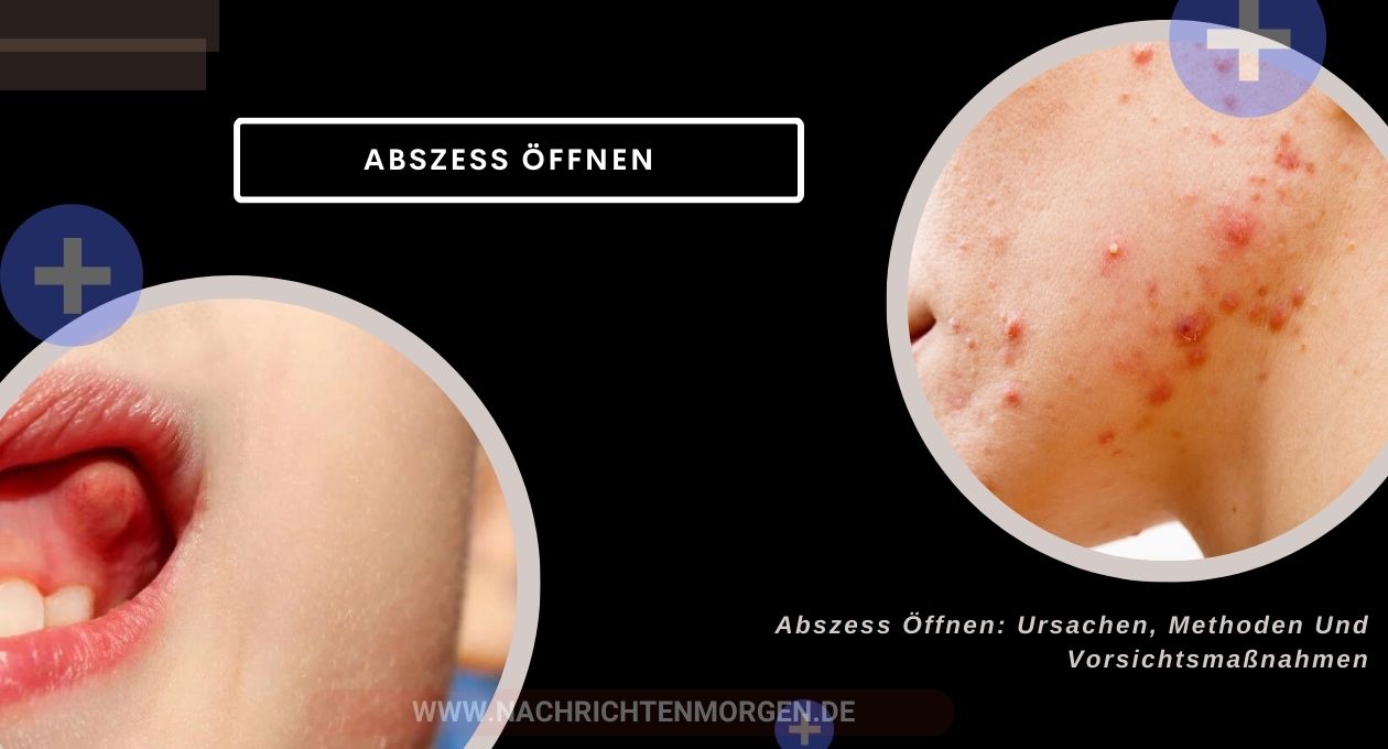 abszess öffnen