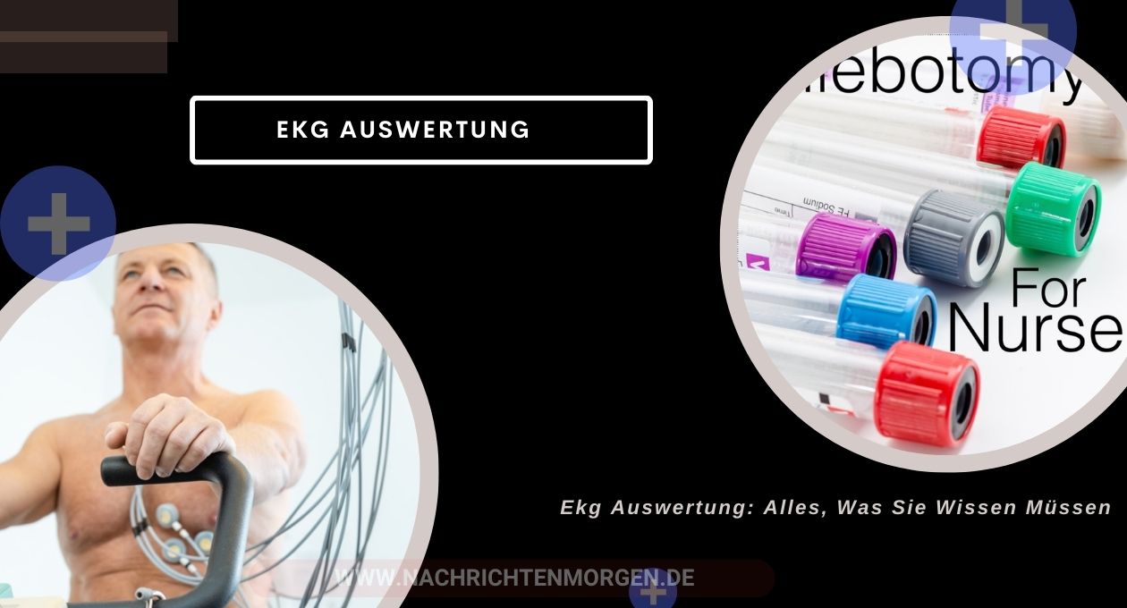 ekg auswertung