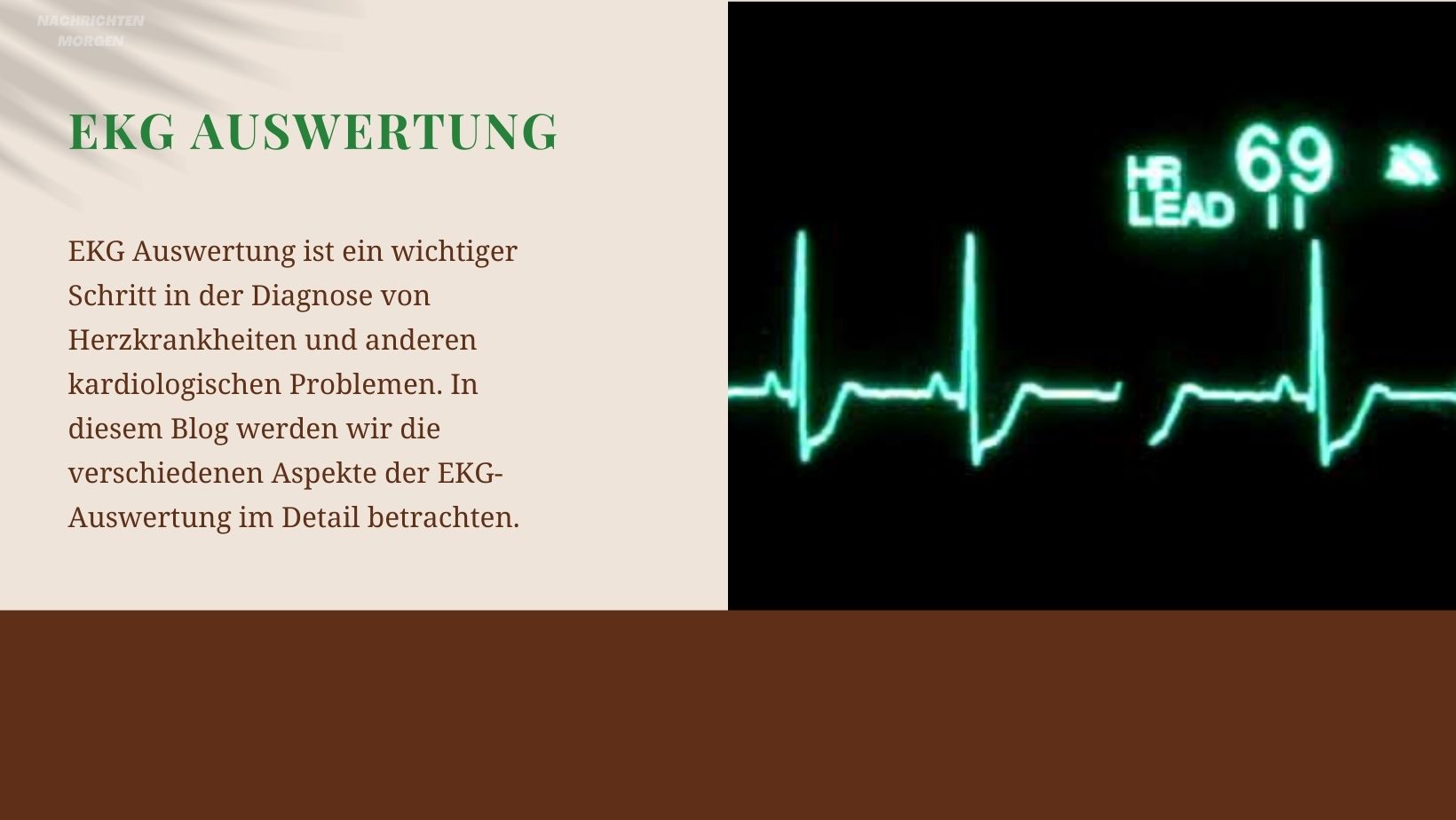 ekg auswertung