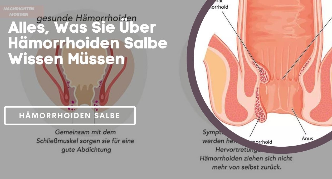 hämorrhoiden salbe