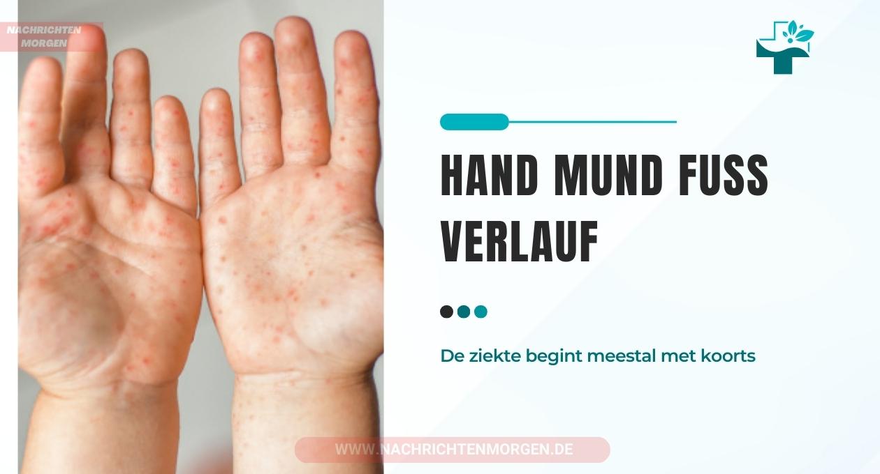 hand mund fuß verlauf